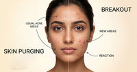 Skin purging vs breakout comparison showing the difference between acne areas and new breakouts