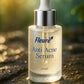 Anti acne serum (30 ml)