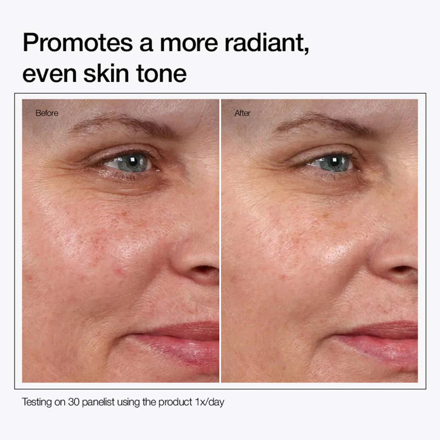 Before and after results of using Fleuré Glycolic Acid 7% Toning Solution for brighter, smoother skin