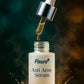 Benefits of Anti-Acne Serum: reduces pimples, fades acne scars, unclogs pores and controls oil for clear skin
