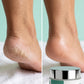 Before and after — cracked heel visibly repaired with Fleuré Feet Crack Cream